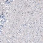 Immunohistochemical staining of human liver shows no positivity in hepatocytes as expected.