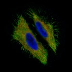 Immunofluorescence staining of HeLa cells using the Anti-MUC16 monoclonal antibody, showing specific staining in the plasma membrane and cytosol in green. Microtubule- and nuclear probes are visualized in red and blue, respectively (where available).