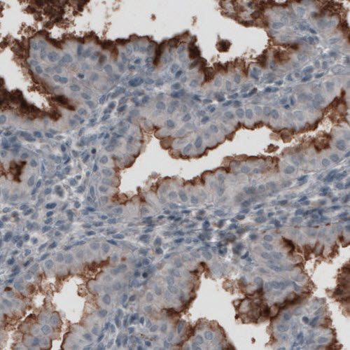 Anti-MUC16 Antibody