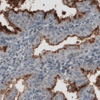 Anti-MUC16 Antibody