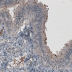 Immunohistochemical staining of human fallopian tube shows positivity in ciliated glandular cells.