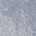 Immunohistochemical staining of human tonsil shows absence of immunoreactivity (negative control).