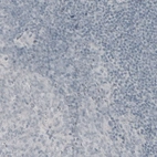 Immunohistochemical staining of human tonsil shows absence of immunoreactivity (negative control).