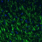 Immunohistochemical staining of mouse cerebral cortex shows strong positivity in myelinated neural fibers.
