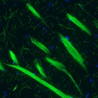 Immunohistochemical staining of mouse striatum shows strong positivity in myelinated fibers.