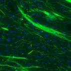 Immunohistochemical staining of mouse striatum shows strong positivity in myelinated fibers.