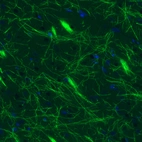 Immunohistochemical staining of rat striatum shows strong immunoreactivity in myelinated neural fibers.