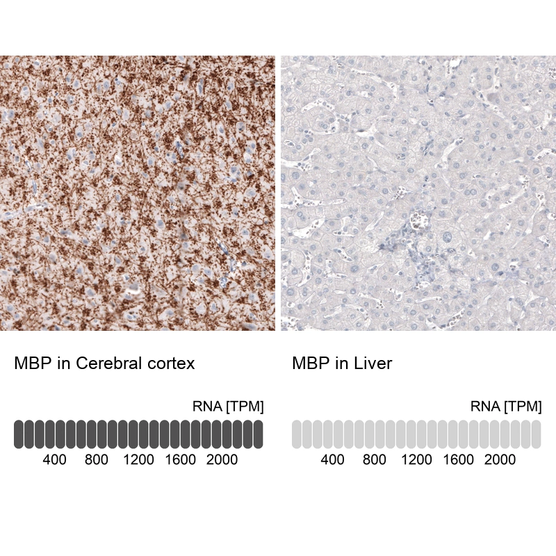 Mouse Monoclonal Anti-MBP Antibody - Buy for research - Highly specific ...