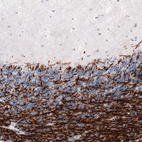 Immunohistochemical staining of human cerebellum shows strong positivity in myelinated neural fiebrs.