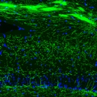 Immunofluorescence staining of mouse hippocampus shows strong positivity in myelinated neural fibers.