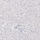 Immunohistochemical staining of human liver shows no positivity in hepatocytes as expected.