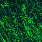 Immunohistochemical staining of rat cerebral cortex shows strong immunoreactivity in myelinated fibers.