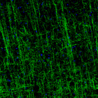 Anti-MOG Antibody