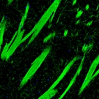 Immunofluorescence staining of mouse basal forebrain shows strong positivity in myelinated neural fibers in the caudate putamen.