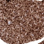 Immunohistochemical staining of human cerebral cortex shows strong positivity in myelinated neural fibers.