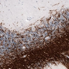 Immunohistochemical staining of human cerebellum shows strong positivity in myelinated neural fibers.