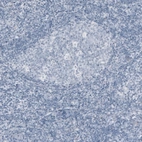 Immunohistochemical staining of human tonsil shows no positivity in lymphoid cells as expected.