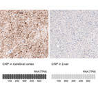 Anti-CNP Antibody