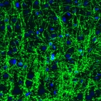 Immunofluorescence staining of rat brain shows strong positivity in oligodendrocytes in cerebral cortex.