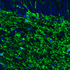 Immunofluorescence staining of rat brain shows strong positivity in oligodendrocytes in the dentate gyrus of the hippocampus.