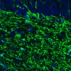 Immunofluorescence staining of rat brain shows strong positivity in oligodendrocytes in the dentate gyrus of the hippocampus.