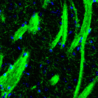 Immunofluorescence staining of mouse basal forebrain shows strong positivity in oligodendrocytes and myelinated fiber tracts in the striatum.