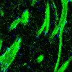 Immunofluorescence staining of mouse basal forebrain shows strong positivity in oligodendrocytes and myelinated fiber tracts in the striatum.