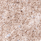 Immunohistochemical staining of human cerebral cortex shows strong cytoplasmic positivity in oligodendrocytes.
