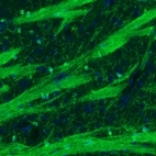 Immunohistochemical staining of mouse striatum shows strong positivity in oligodendrocytes and myelinated neural fibers.