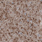 Anti-CNP Antibody