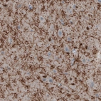 Immunohistochemical staining of human cerebral cortex shows strong immunoreactivity in oligodendrocytes.