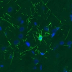 Immunohistochemical staining of rat cerebral cortex shows strong immunoreactivity in a single oligodendrocyte.