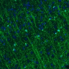 Immunohistochemical staining of mouse cerebral cortex shows strong immunoreactivity in oligodendrocytes.