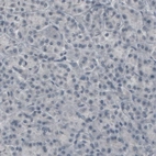 Immunohistochemical staining of human pancreas shows absence of immunoreactivity (negative control).
