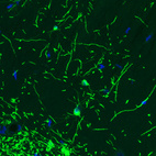 Immunofluorescence staining of rat brain shows strong positivity in oligodendrocytes in the hippocampus.