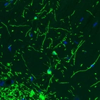 Immunofluorescence staining of rat brain shows strong positivity in oligodendrocytes in the hippocampus.