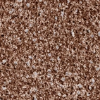 Immunohistochemical staining of human cerebral cortex shows strong positivity in oligodendrocytes.