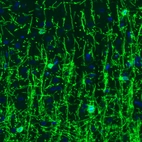 Immunohistochemical staining of rat brain shows strong positivity in oligodendrocytes in cerebral cortex.