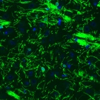 Immunofluorescence staining of mouse brain shows strong positivity in oligodendrocytes in the amygdala.