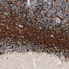 Immunohistochemical staining of human cerebellum shows strong positivity in oligodendrocytes.