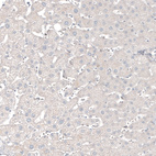 Immunohistochemical staining of human liver shows no positivity in hepatocytes as expected.
