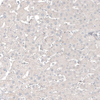 Anti-CNP Antibody