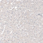 Immunohistochemical staining of human liver shows no positivity in hepatocytes as expected.