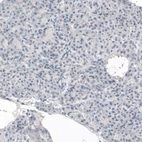Immunohistochemical staining of human pancreas shows no positivity in exocrine glandular cells as expected.