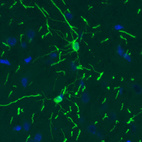 Immunohistochemical staining of rat cerebral cortex shows strong immunoreactivity in single oligodendrocytes.