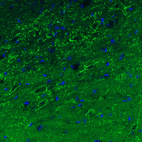 Immunohistochemical staining of mouse substantia nigra shows strong immunoreactivity in GABAergic neural processes.