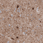 Anti-GAD1 Antibody