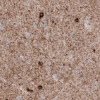 Immunohistochemical staining of human cerebral cortex shows immunoreactivity in neuropil, as well as some neuronal cells bodies.