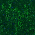 Immunohistochemical staining of rat cerebral cortex shows strong positivity in GABAergic synapses on pyramidal neurons.