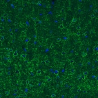 Anti-GAD1 Antibody